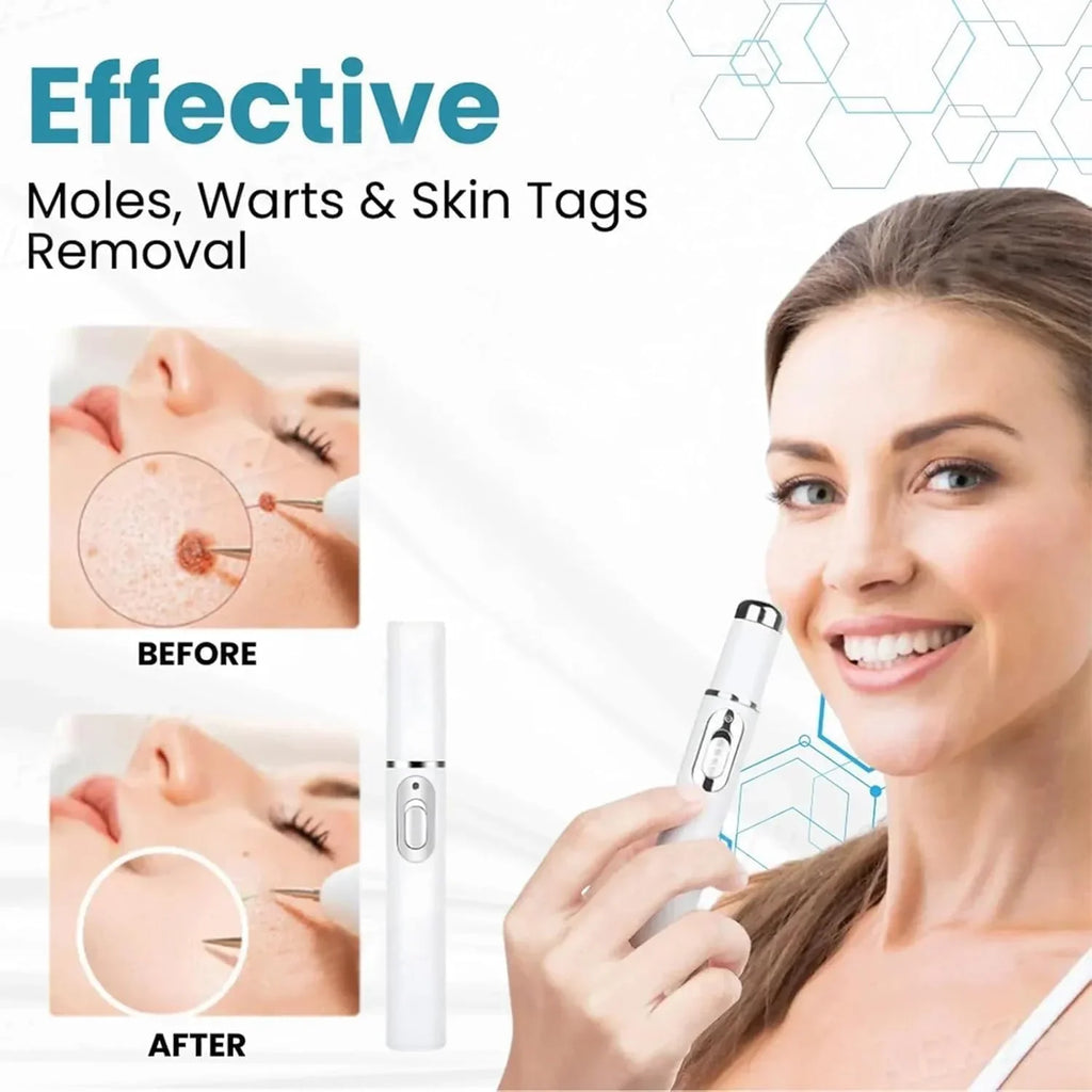 Non-Invasive Mole and Wart Removal Pen